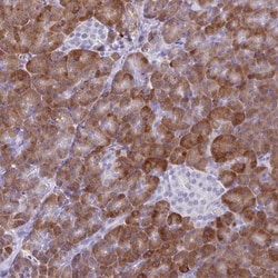 NCCRP1 Antibody, Novus Biologicals 0.1mL; Unlabeled:Antibodies, Polyclonal